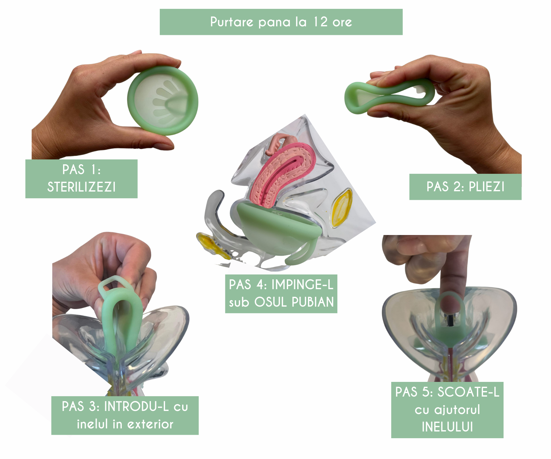 Ghid vizual cu 5 pași pentru folosirea discului menstrual Femi.Eko®: sterilizare, pliere, introducere cu inelul spre exterior, poziționare sub osul pubian și extragere ușoară cu ajutorul inelului. Purtare până la 12 ore.